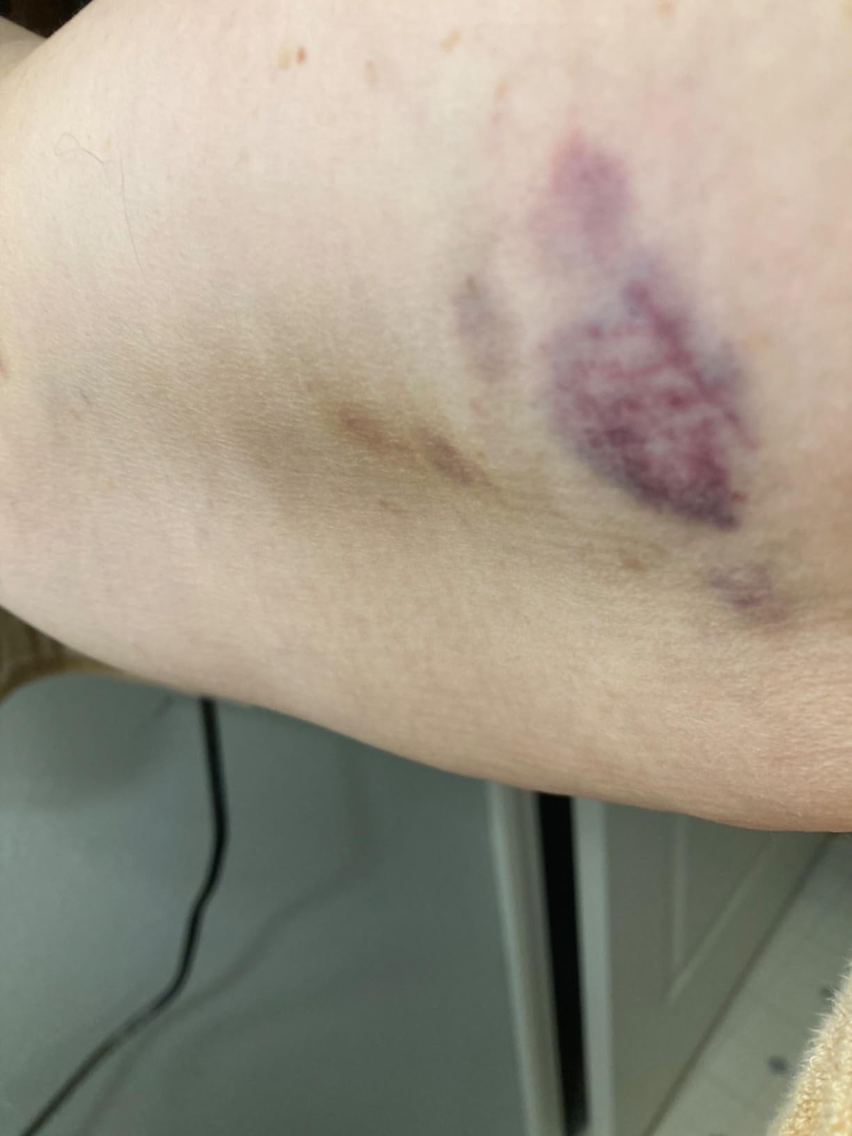 A&D Medical UA-789AC Blood Pressure Monitor with Extra Large Cuff 16.5-23.6 inches customer photo 2