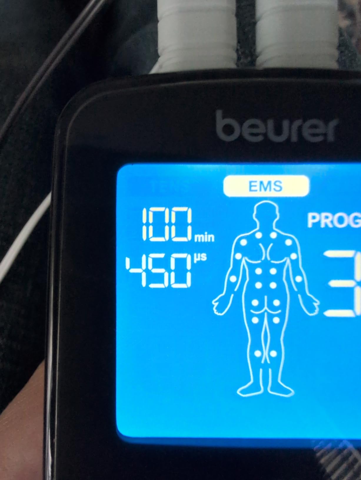 Beurer EM59 Digital 3-in-1 TENS Unit, EMS & Heat Therapy for Pain Relief & Relaxation, Muscle Stimulator with 2 Adjustable Channels, 64 Applications, Timer Function customer photo 1