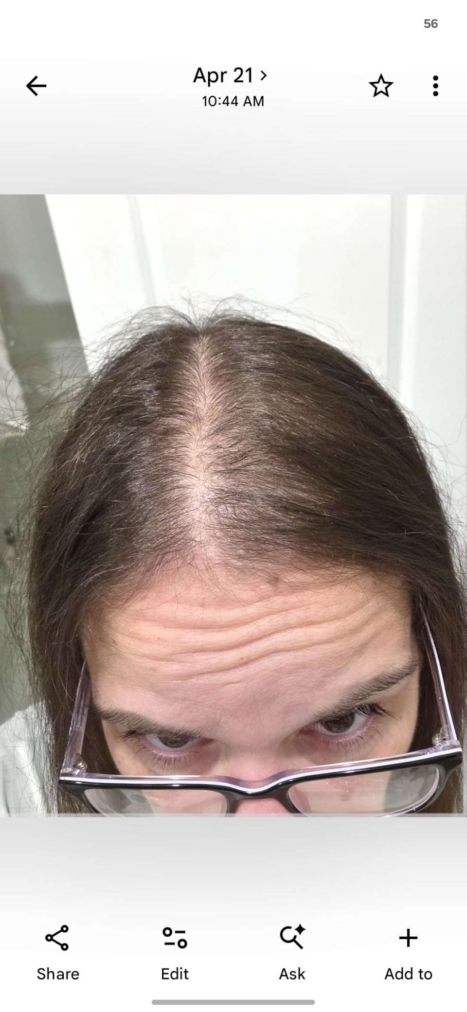 WEEM Hair Skin and Nails Gummies - Supports Healthy Hair - Vegan biotin Vitamins for Women & Men Supports Faster Hair Growth, Stronger Nails, Healthy Skin, Extra Strength (1) customer photo 2