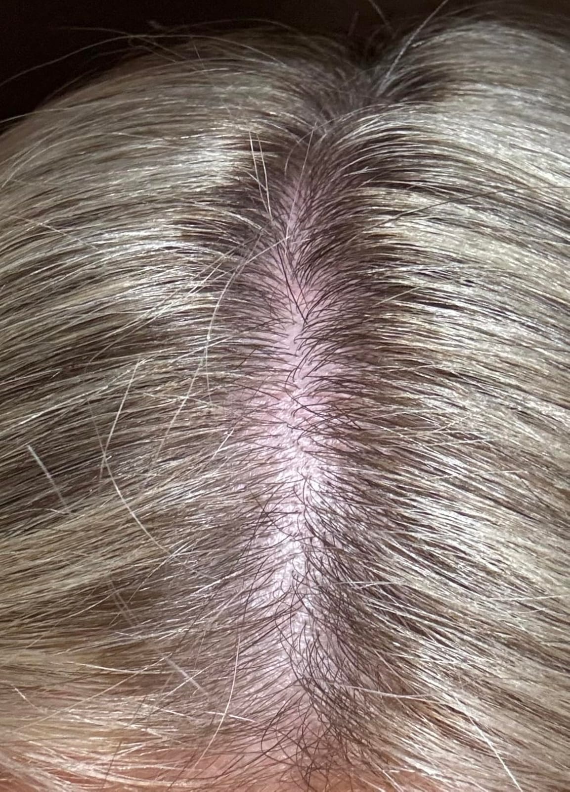 Biotin, Collagen, Hyaluronic Acid & Keratin - Hair Growth Support - 60 Caps customer photo 1