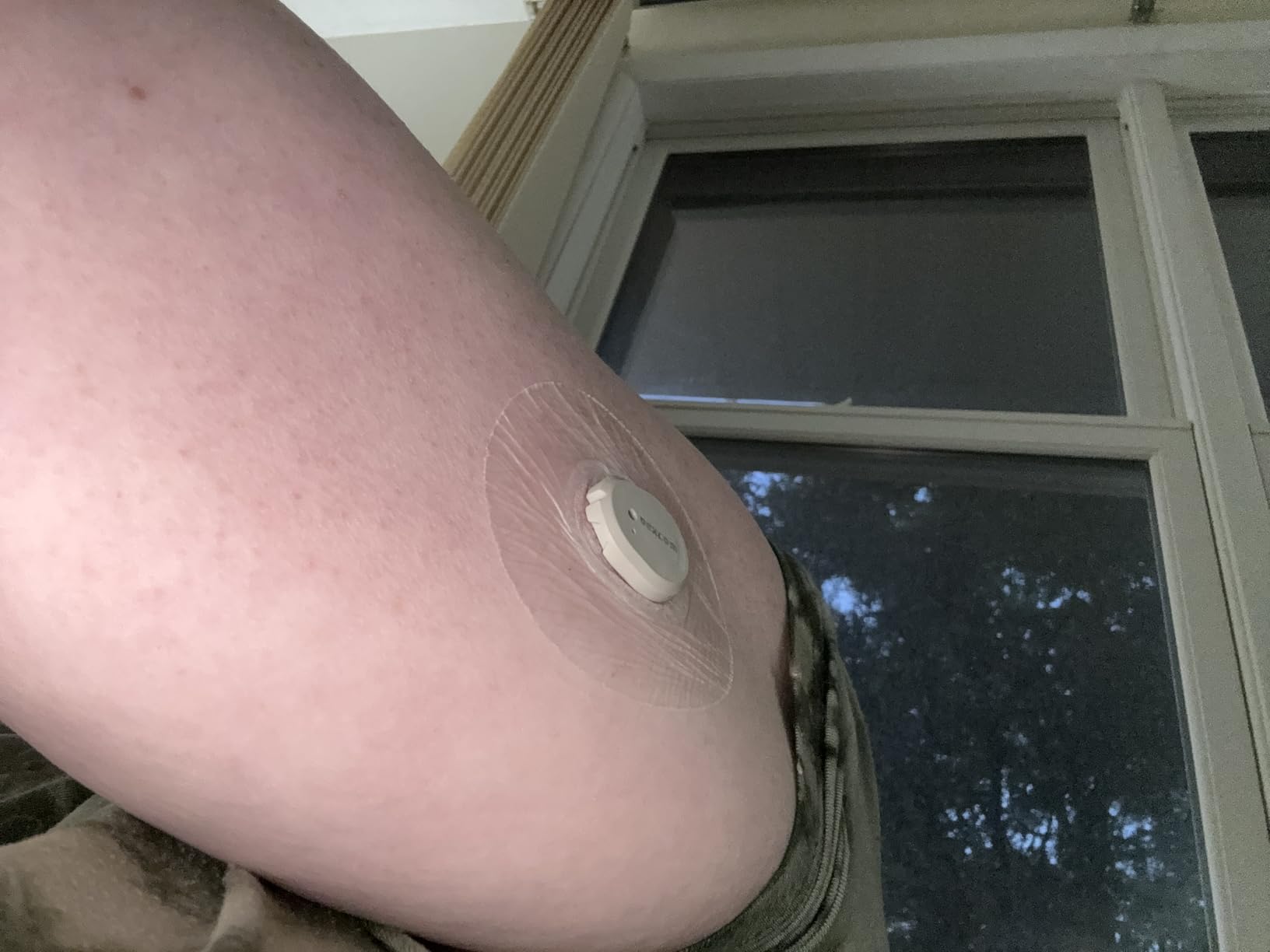 Dexcom G7 Over Patches Waterproof 30 Pack, Strong Hold 15 Days Clear | Sweatproof, Hypoallergenic Latex-Free CGM Sensor Cover for Dexcom G7 & Stelo customer photo 1