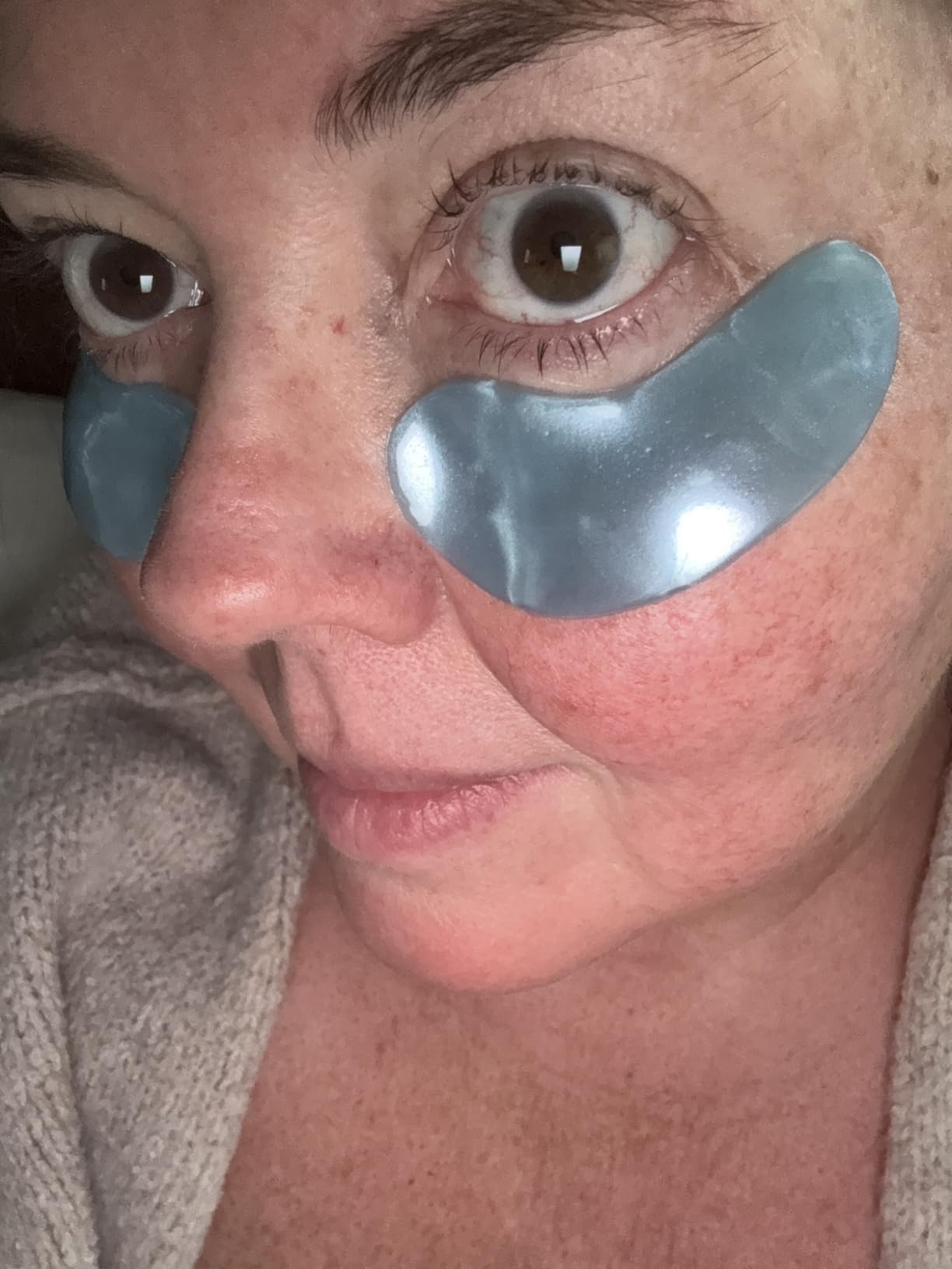 grace & stella Award Winning Under Eye Mask - Teen Gifts, Gel Eye Patches for Dark Circles, Puffy Eyes, Wrinkles, Undereye Bags, Travel Gifts for Women - Vegan, Self Care (6 Pairs, Gold) customer photo 2