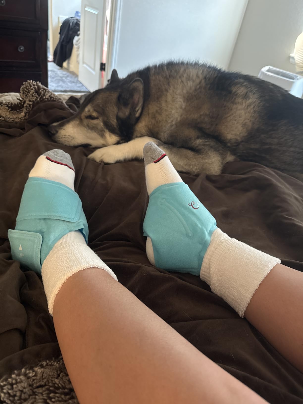 Comfytemp Ankle Ice Pack Wrap for Plantar Fasciitis, Foot Pain Relief, 2pcs customer photo 1
